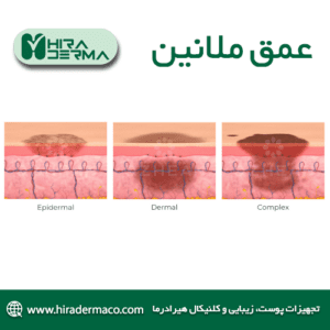 هایپرپیگمنتیشن عمق ملانین