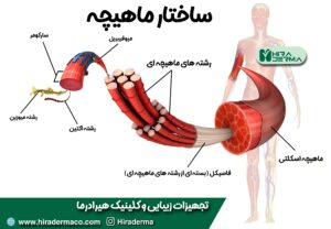 تکنولوژی EMS در هیرادرما