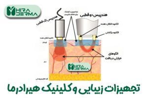 هندپیس‌های RF مزایای آر اف