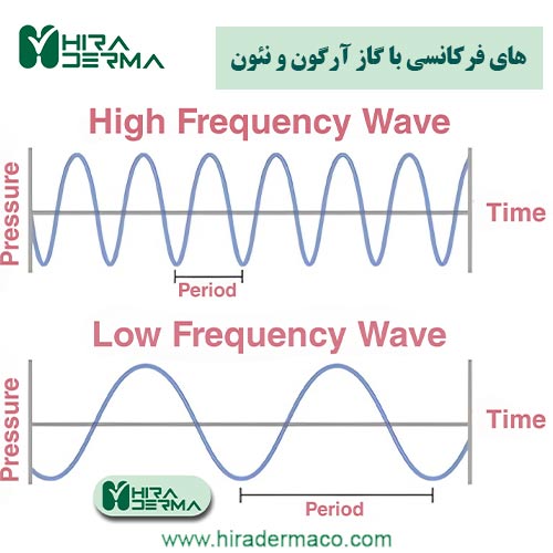 های فرکانسی با گاز آرگون و نئون هیرادرما